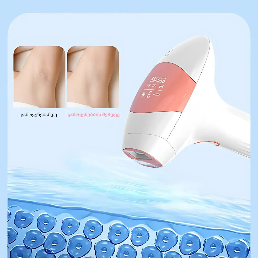 Lumivea Prestige IPL ეპილატორი – მაქსიმალური კომფორტი და ეფექტურობა DepMall