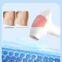 Lumivea Prestige IPL ეპილატორი – მაქსიმალური კომფორტი და ეფექტურობა DepMall