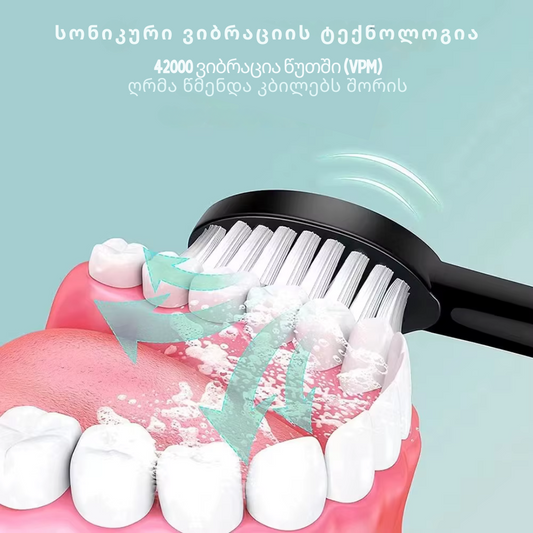სონიკური ელექტრო ჯაგრისი
